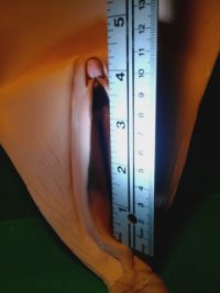 Frontline medical supply inc picture