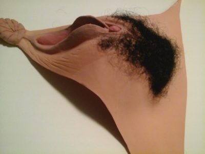 Independence prosthetics picture